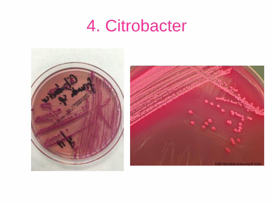 (PDF) Gram Negative Bacteria - WeeblyEscherichia coli (E.coli) 2 ...